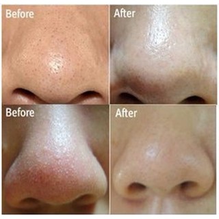 Mặt nạ đẩy mụn đầu đen Ciracle Goodbye Blackhead