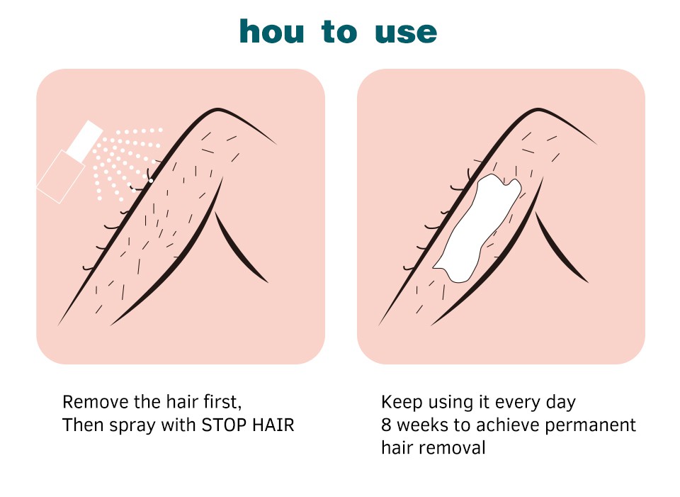 [Hàng mới về] Thuốc xịt ức chế mọc lông không gây kích ứng giữ ẩm nhẹ dành cho toàn thân