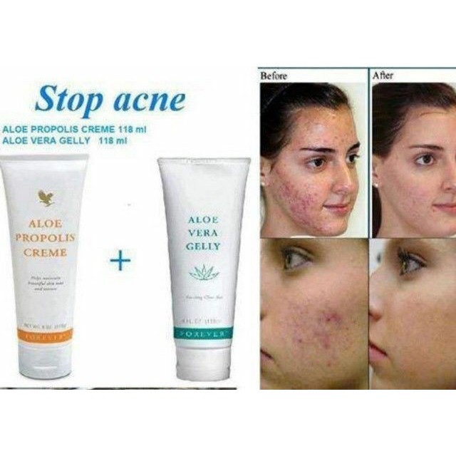 Combo 2 kem dưỡng da aloe vera gelly và aloe propolis