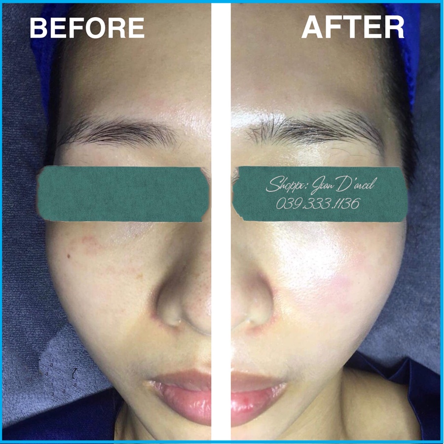 Huyết thanh vitamin làm trắng sáng da Jean D'Arcel _ Jean Darcel Restorative Concentrate