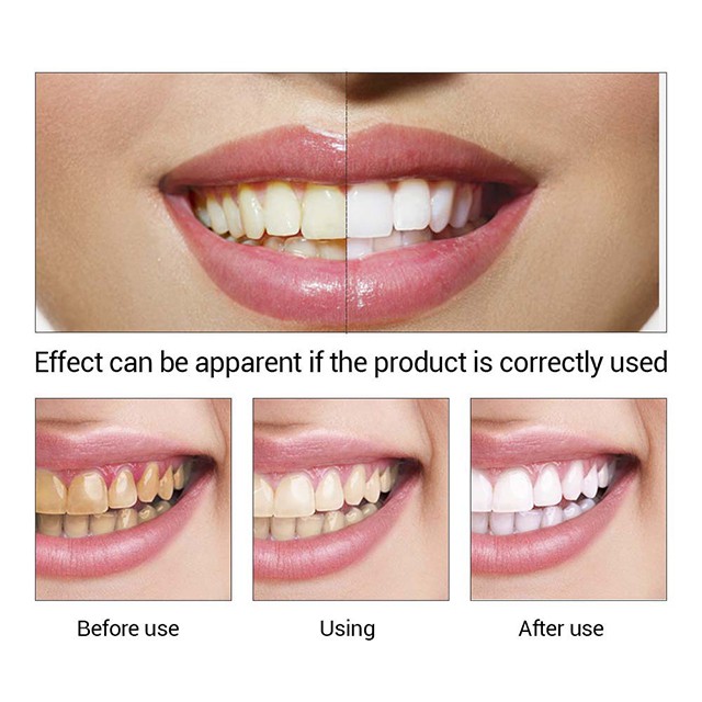 Chai 10ml Tinh Chất Tẩy Trắng Răng Làm Sạch Răng LANBENA Teeth Whitening Essense