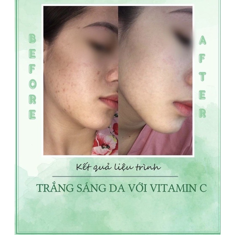 LIỆU TRÌNH 5 BUỔI ĐIỆN DI VITAMIN C