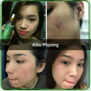 SERUM THẢO DƯỢC THIÊN NHIÊN NGỌC LINH SÂM
