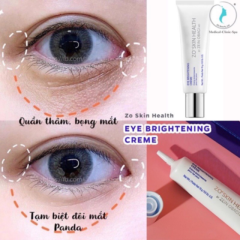 Kem dưỡng sáng da mắt ZO EYE BRIGHTENING CREME