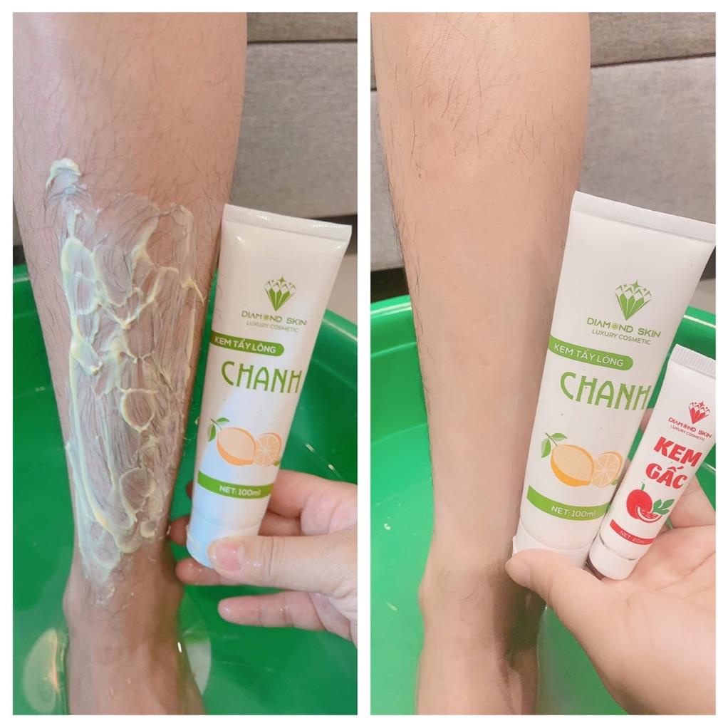 COMBO KEM TẨY LÔNG CHANH GẤC DIAMOND SKIN CHÍNH HÃNG (TRIỆT LÔNG CHANH GẤC DIAMOND SKIN) | BigBuy360 - bigbuy360.vn