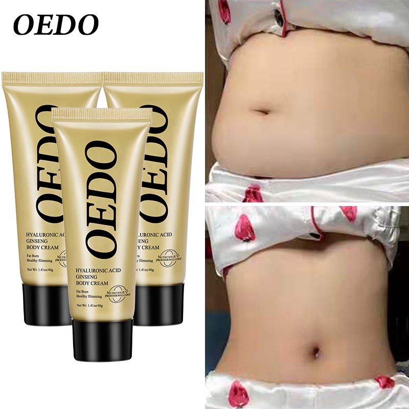 Set 3 tuýp kem bôi làm tan mỡ thừa giảm cân hiệu quả OEDO