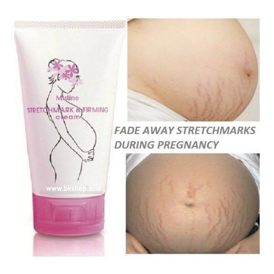 (Auth Thái) Kem Hỗ Trợ Giảm  Rạn Da cho mẹ bầu Mistine
