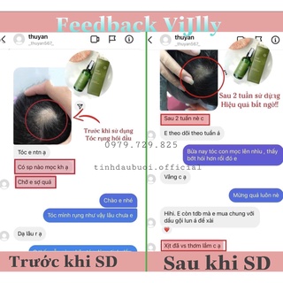 Combo 5 Chai Xịt Tóc Tinh Dầu Bưởi Giúp Mọc Tóc, Chăm Sóc Tóc