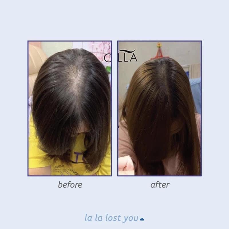 Dầu dưỡng giúp mọc tóc Vaseline Hair Tonic 100Ml - ĐỦ BILL