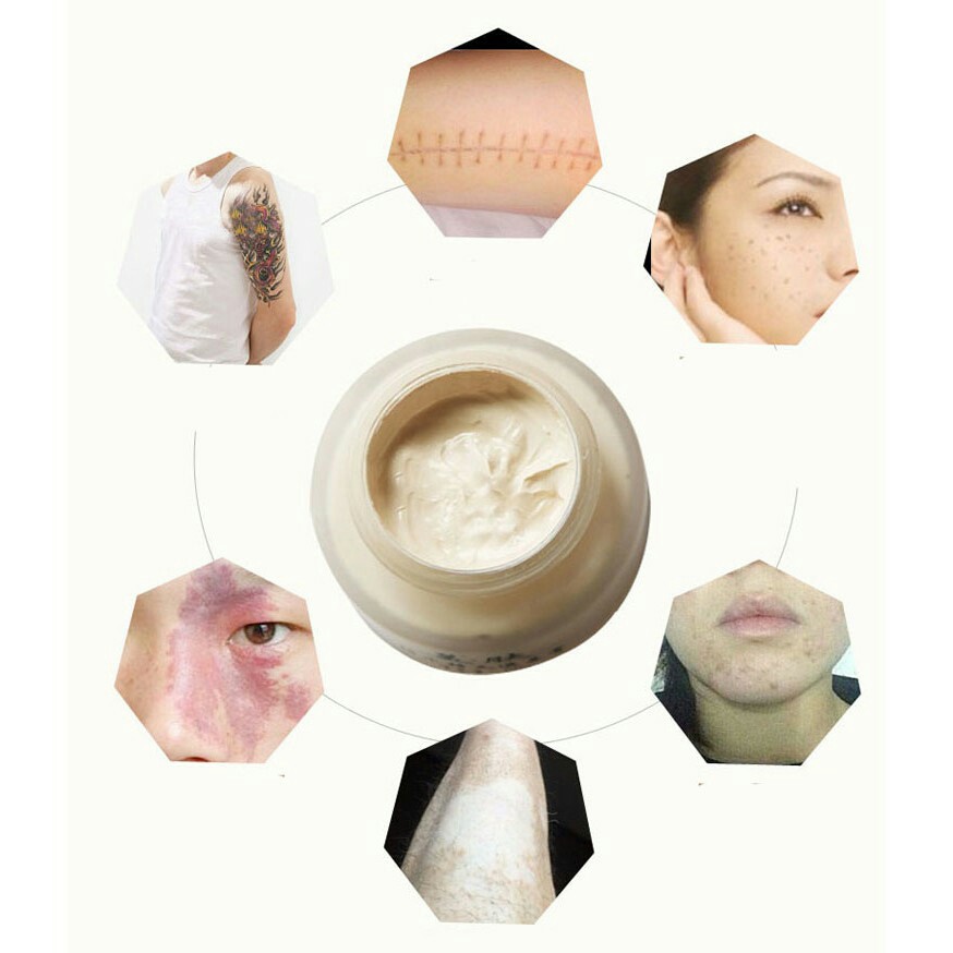 Kem che sẹo 2 mầu Demacare | BigBuy360 - bigbuy360.vn