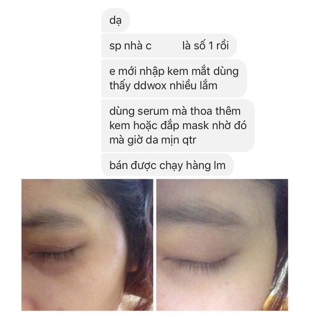 Eye cream - Loại bỏ thâm quầng mắt dưỡng da mặt