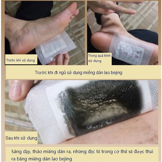 [Xả kho]Miếng dán thải độc giảm mỡ thừa