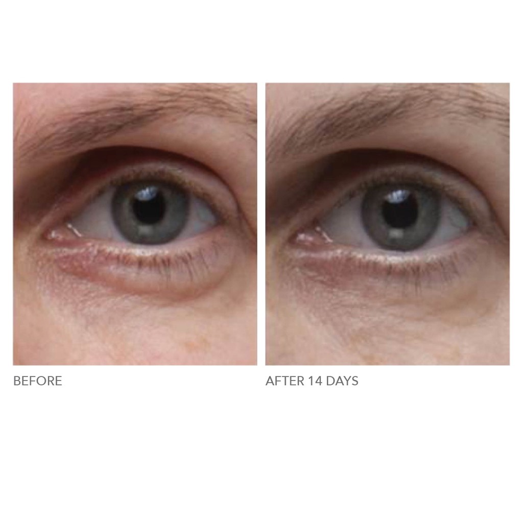 [Unbox/ Fullbox] Serum Giảm Quầng Thâm, Nếp Nhăn Dr Dennis Gross Skincare Ferulic + Retinol Triple Correction Eye Serum