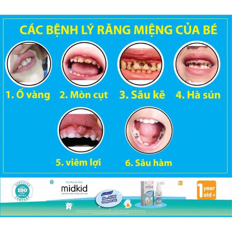 Xịt chống sâu răng Midkid ngừa sâu răng hôi miệng giảm ê buốt răng ố vàng viêm lợi trắng răng sún răng đen Lọ 30ml