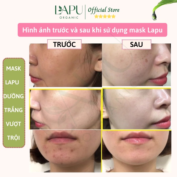 Mặt nạ dẻo collagen hoa hồng - Mask dẻo đắp mặt giúp đàn hồi da, làm trắng da ngăn ngừa nám, tàn nhang LAPU Organic