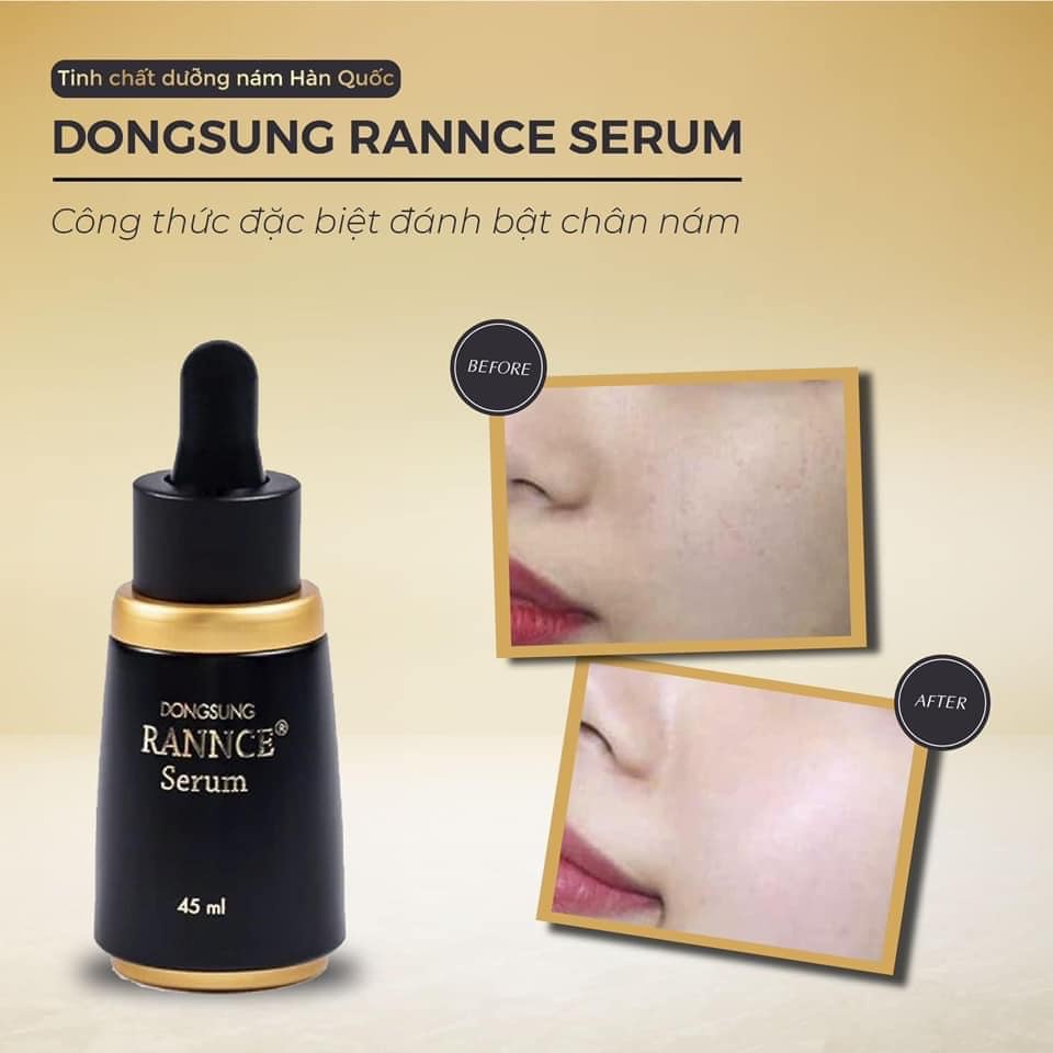 Tinh Chất Hỗ Trợ Giảm Mờ Và Ngăn Ngừa Thâm Nám Dongsung Rannce Serum - 45 ml