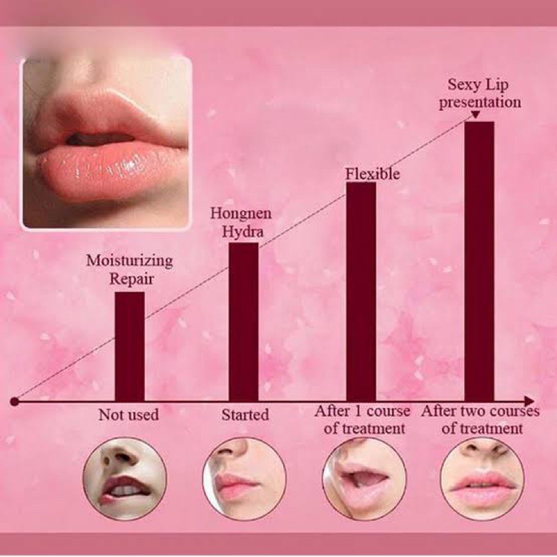 (hàng Mới Về) Mặt Nạ Môi Bioaqua Collagen Dưỡng Ẩm / Làm Đẹp Hiệu Quả | BigBuy360 - bigbuy360.vn