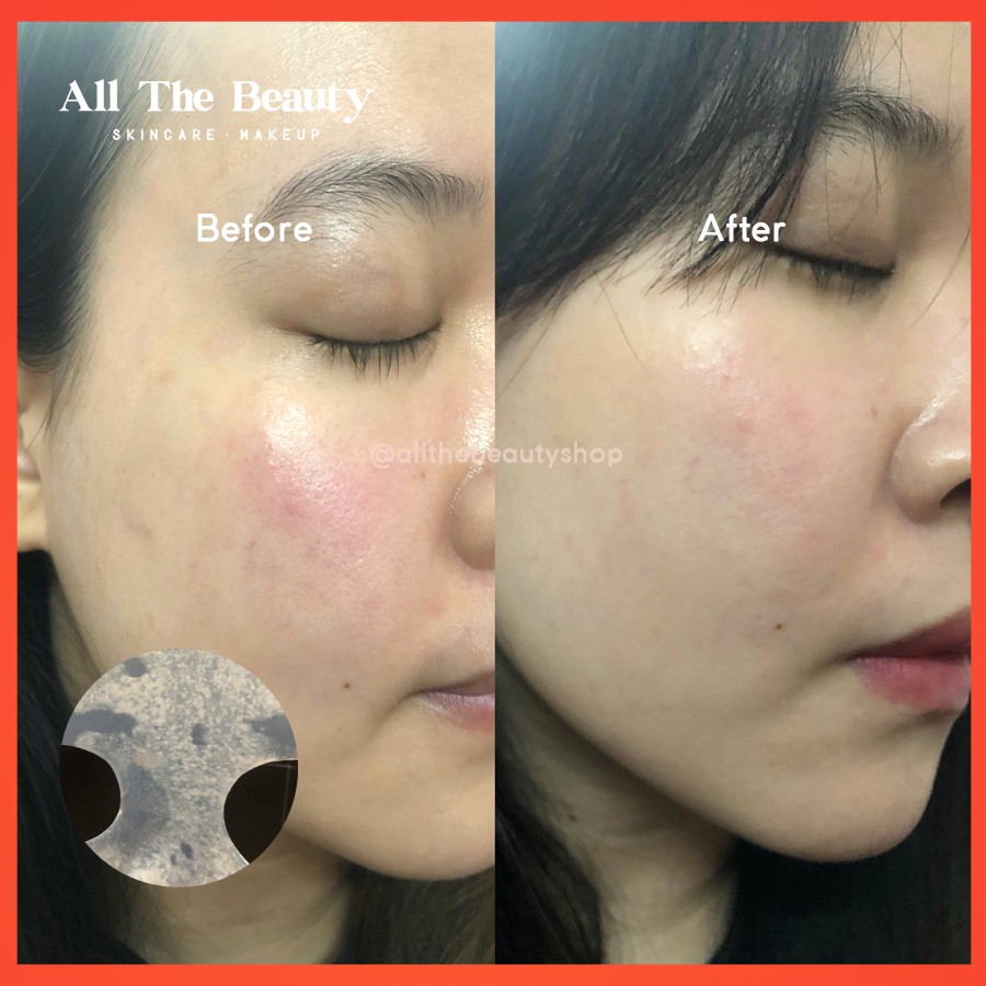 [HOT] Mặt nạ làm sạch sâu Beauty Player (Đen) | Thế Giới Skin Care