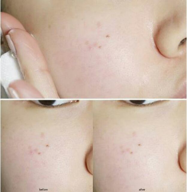 Nước hoa hồng Laneige da khô Skin Refiner Moisture cấp ẩm