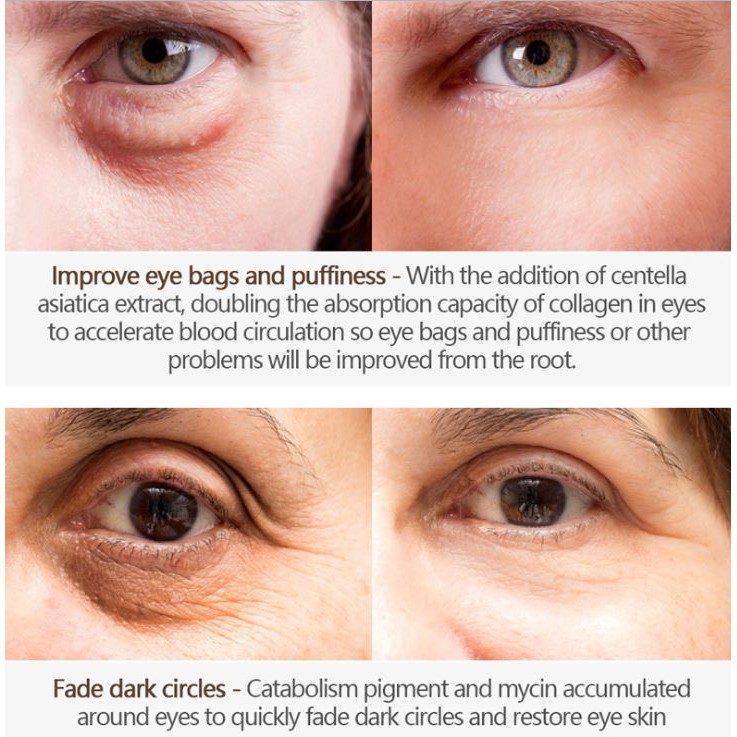 Kem làm mờ quầng thâm - bọng mắt - vết nhăn Cayman Eye Cream Vibrant Glamour EN