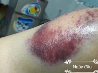 Cao thảo mộc ayofa(cao mát xa đa năng)