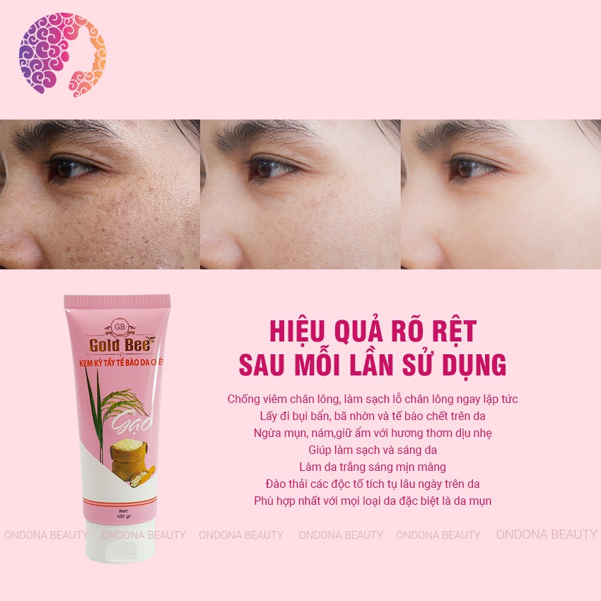 [Real Natural] KEM TẨY KỲ TẾ BÀO DA CHẾT TINH CHẤT GẠO (dành cho da mặt) Gold Bee - Ondona Beauty