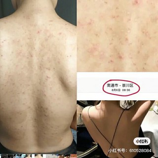 Sữa tắm aderma sạch mụn lưng 500ml