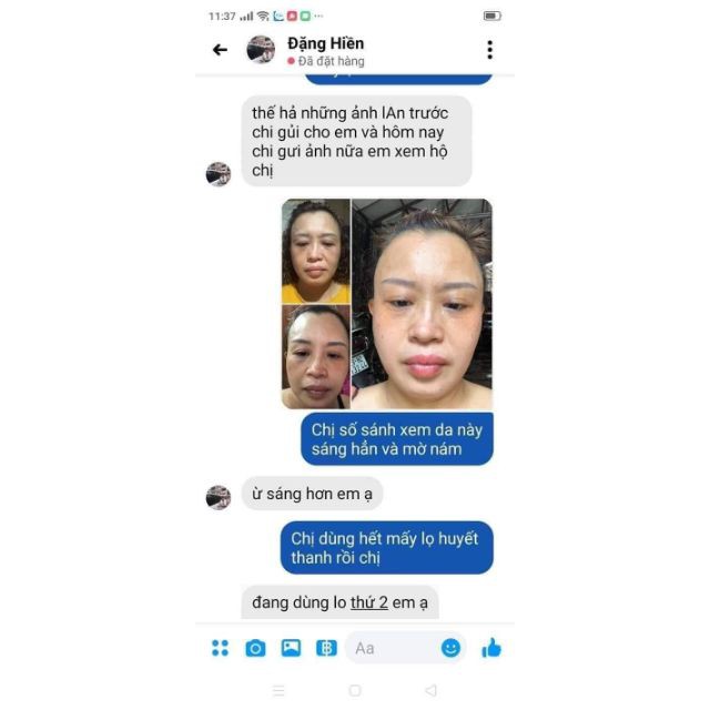 Serum Truyền Trắng 7 Days Olic 10ml - [ Hàng Chuẩn Cty ] | BigBuy360 - bigbuy360.vn