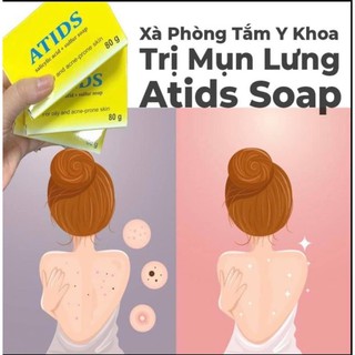 Xà Phòng ATIDS Giảm Mụn Lưng