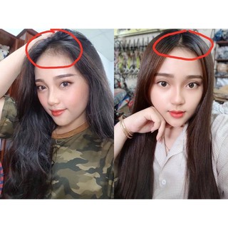 xịt mọc tóc Y lang mọc tóc dài nhanh