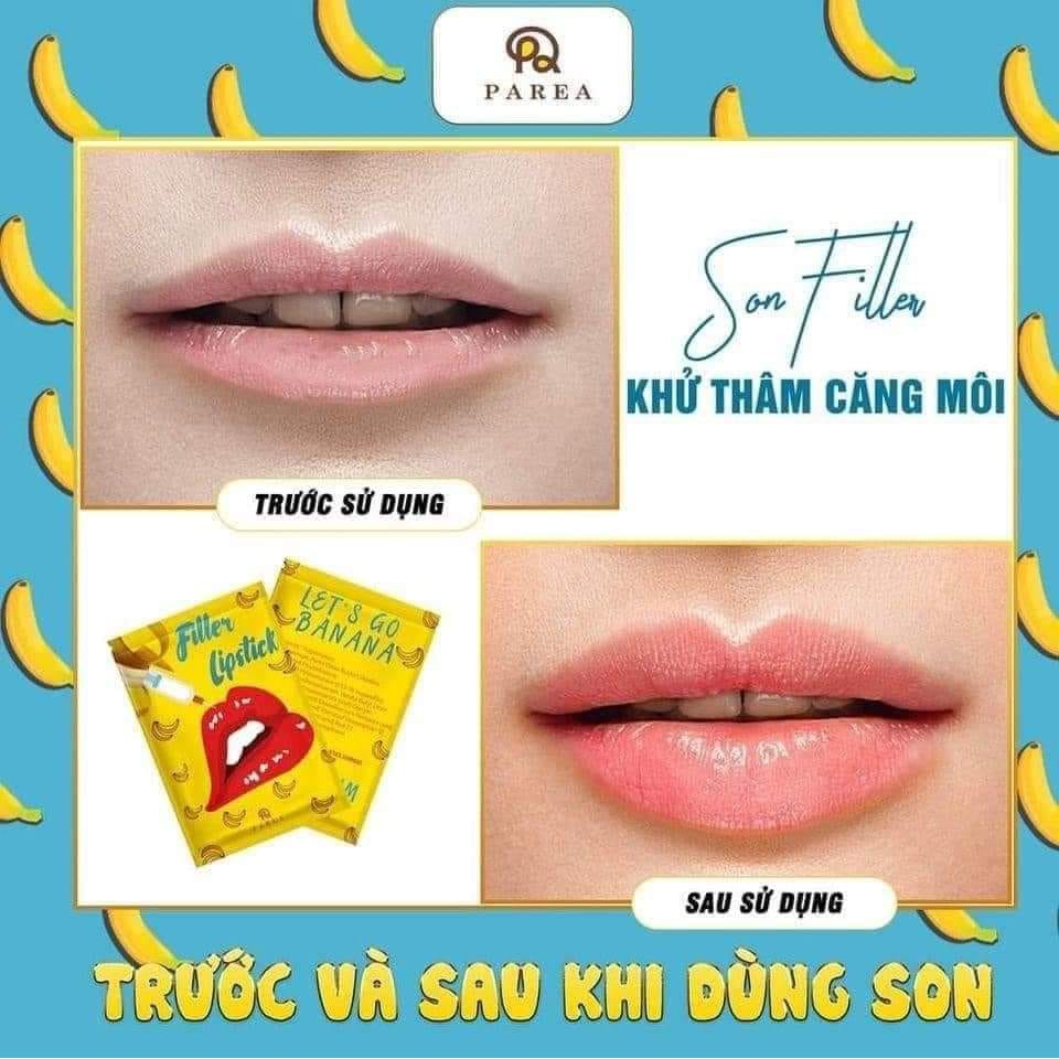 Son Filler Collagen Chuối Khử Thâm Parea cùng son màu Chu Lipstick, giúp môi căng mọng Chính Hãng | BigBuy360 - bigbuy360.vn