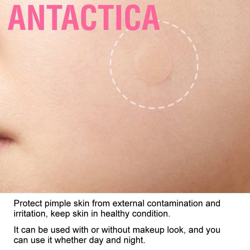 Set 36 Miếng Dán Che Mụn Chống Thấm Nước Thoáng Khí | BigBuy360 - bigbuy360.vn