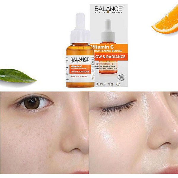 Tinh Chất Làm Sáng Da Balance Active Formula Gold Vitamin C Hyaluronic Serum Niacinamide 15% Blemish Recovery 30ml