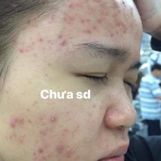TIÊN TIÊN DƯỢC handmade