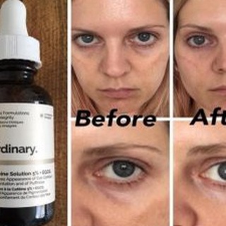 Serum mắt Caffeine Solution 5% + EGCG - The Ordinary