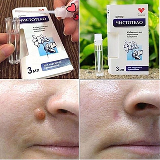Gel tẩy nốt ruồi Nga