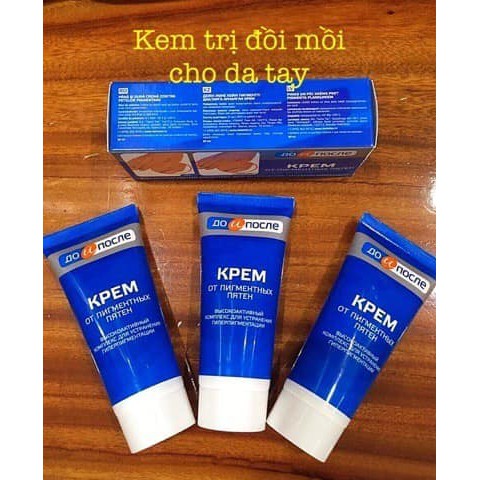 Kem dưỡng da tay giảm đồi mồi tàn nhang KPEM của Nga 50ml