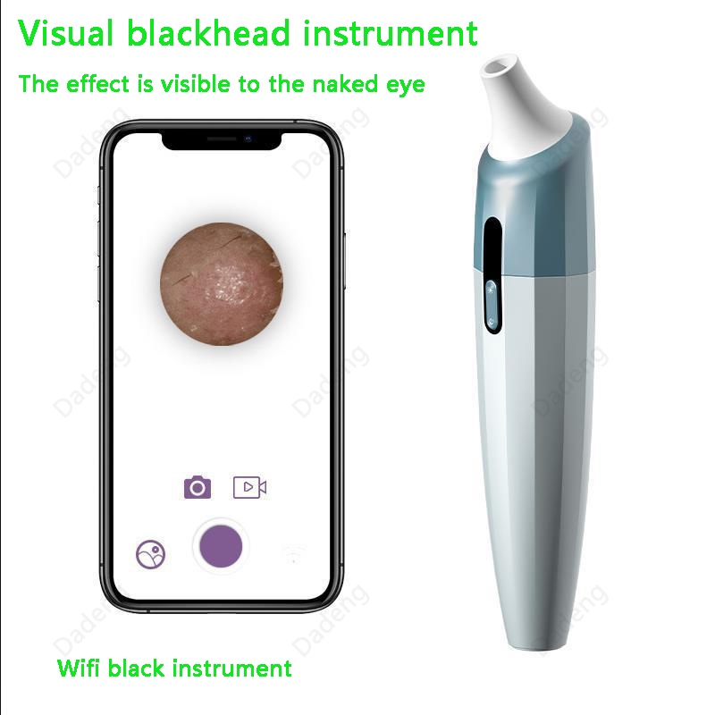 Dụng cụ hỗ trợ loại bỏ mụn đầu đen thông minh bằng điện cho vùng mũi làm sạch lỗ chân lông