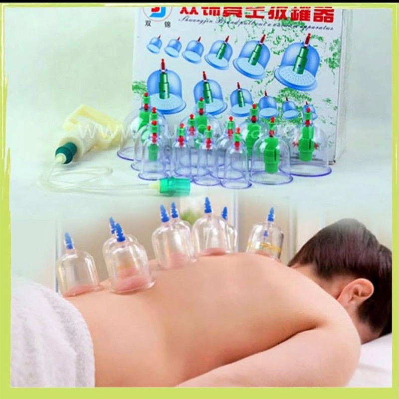 Bộ giác hơi 12 ly hút chân không.Giác hơi không dùng lửa-an toàn.