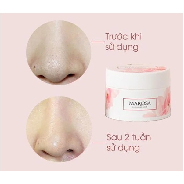 Tẩy tế bào chết Marosa Laco làm sạch da, bã nhờn, biểu bì, tẩy da chết, phục hồi làn da sáng trắng | BigBuy360 - bigbuy360.vn