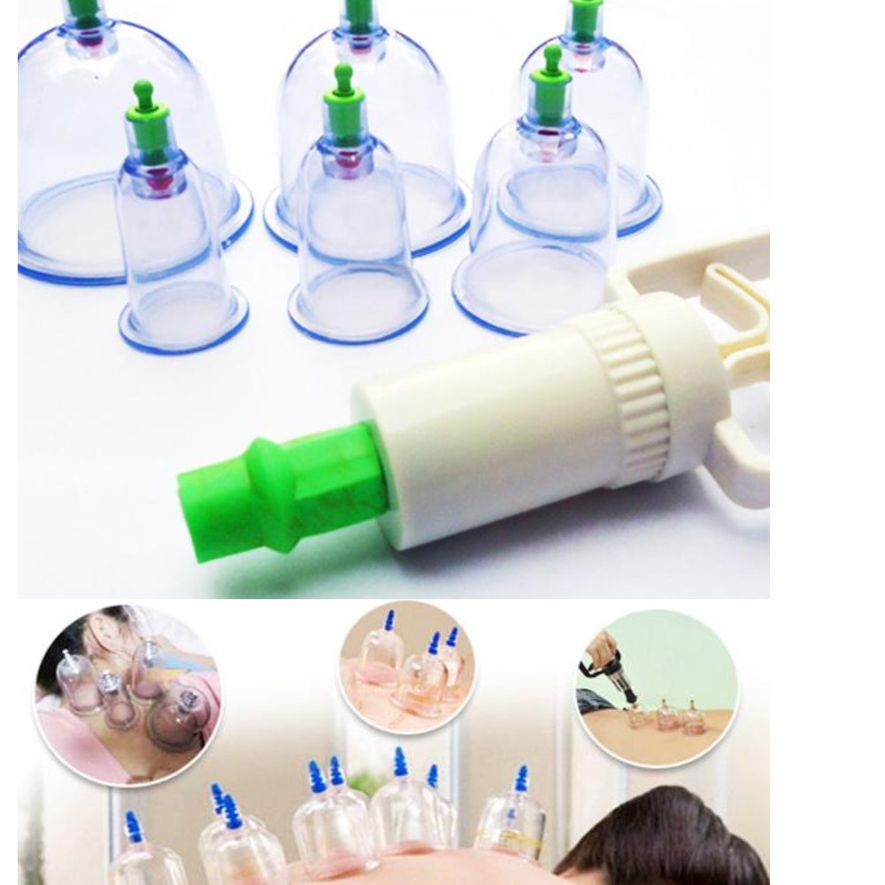 Bộ Giác Hơi 12 Ống Hút Chân Không,không cần dùng lửa - dùng an toàn tại nhà - dễ sử dụng