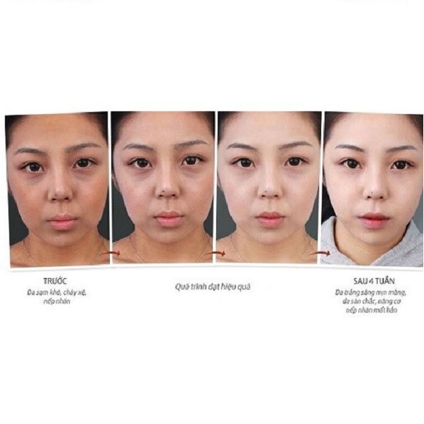 Tinh Chất Dưỡng Trắng Angel's Liquid 7Day Whitening Program Glutathione 700 V-Ample 30ml