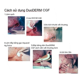 Miếng Dán Chống Loét- DuoDerm CGF, chống lở loét, tỳ đè vết thương