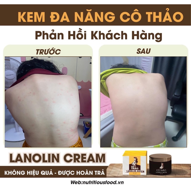 Kem Đa NĂNG CÔ THẢO Hộp 30gr Giải quyết mọi vấn đề về Da