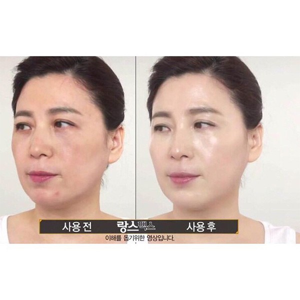Nước hoa hồng/Tinh chất/ Kem dưỡng trắng da, ngăn ngừa nám Dongsung Rannce Skin/ C-Serum/ Cream