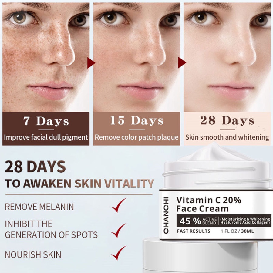 Kem Vitamin C 20% Làm Trắng Xóa Đốm Đen Trên Da Mặt Hiệu GLAMN