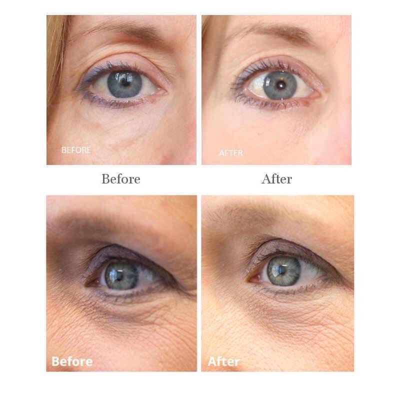 [Hàng có săxn +bill ] Kem chống lão hoá mắt Swisse Skincare Argan Revitalising Eye Cream 15ml[ mẫu mới] | BigBuy360 - bigbuy360.vn