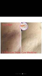 Cao thâm fourets cosmetics