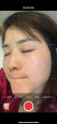 SERUM ĐĂC TRỊ NÁM MỤN CC MELANO