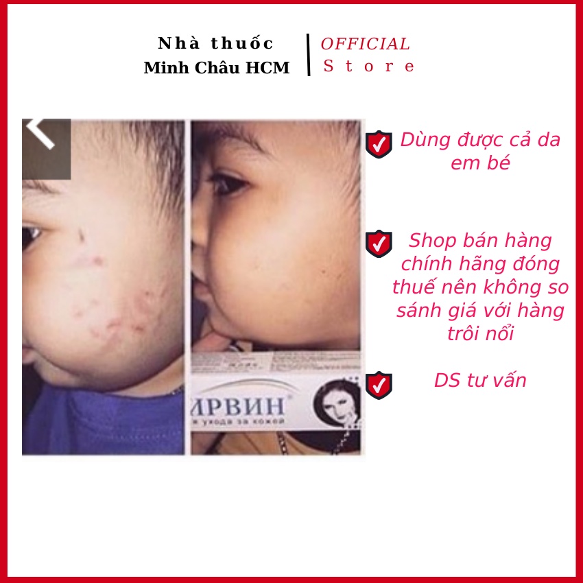 Kem giảm sẹo lồi, sẹo rỗ, sẹo thâm Nga Klirvin 25g nhập khẩu chính hãng - nhà thuốc Minh Châu HCM